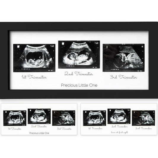 Baby Sonogram Picture Frames - Trio Ultrasound Picture Frames, First Time Mom Gift (Onyx Black)